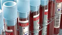 curso online diagnostico tratamiento infeccion vih sida