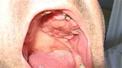 ##IMAGE##