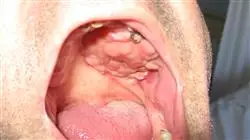 ##IMAGE##