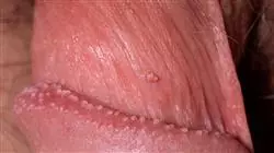 ##IMAGE##