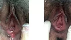 ##IMAGE##