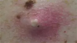 ##IMAGE##