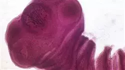 ##IMAGE##