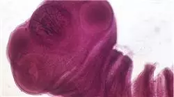 ##IMAGE##