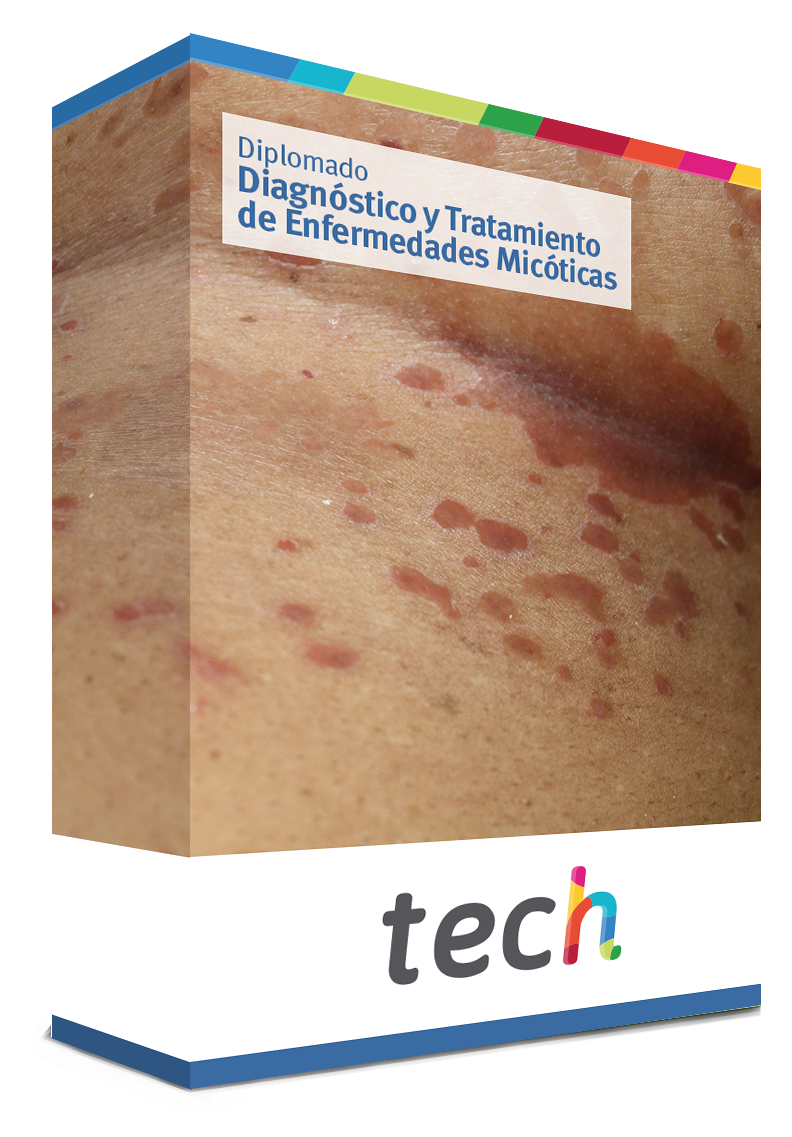 diplomado diagnostico tratamiento enfermedades micoticas caja