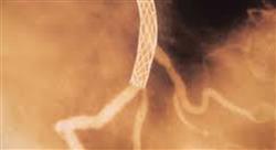 especializacion insuficiencia cardíaca shock cardiogénico y síndrome coronario agudo