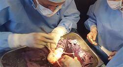 diplomado online cirugía de trasplante renal