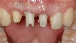 master online odontologia estetica adhesiva