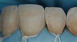 posgrado odontología estética adhesiva