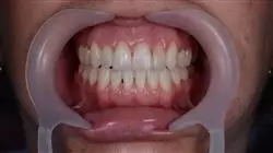 ##IMAGE##