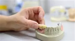 maestria periodoncia implantología y cirugía bucal