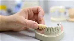 ##IMAGE##
