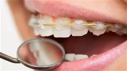 maestria online endodoncia microcirugia apical