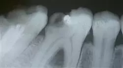 ##IMAGE##