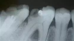 ##IMAGE##