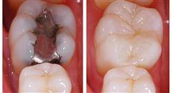 posgrado endodoncia y microcirugía apical
