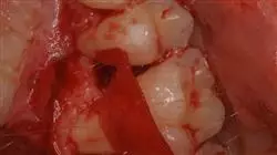 ##IMAGE##