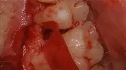 ##IMAGE##