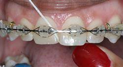 especializacion online ortodoncia clínica