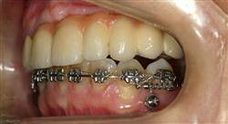 especializacion ortodoncia clínica
