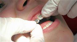 cursos ortodoncia avanzada