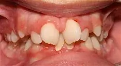 especializacion ortodoncia avanzada