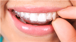 formacion online ortodoncia avanzada