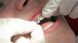 plantilla expertoespecializacion online ortodoncia avanzada