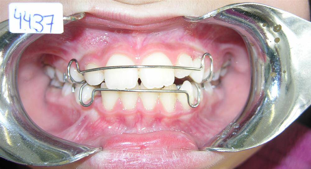 experto universitario dentofacial
