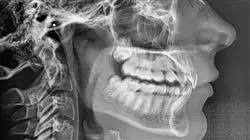 especializacion online ortopedia dentofacial