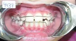 especialización dentofacial