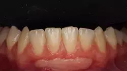 ##IMAGE##