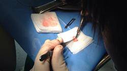 periodoncia cirugia mucogingivals