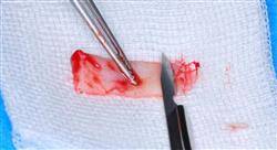 posgrado periodoncia y cirugía mucogingival