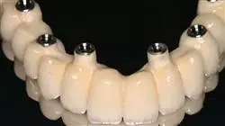 ##IMAGE##