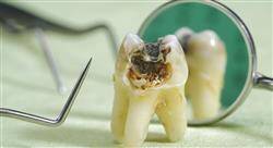 diplomado periodoncia y endodoncia