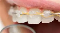 ##IMAGE##