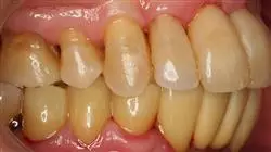 curso periodoncia ortodoncia oclusion