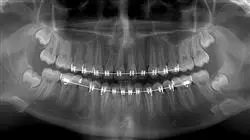 curso periodoncia ortodoncia oclusionn