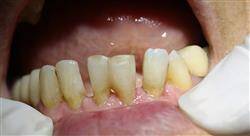 curso periodoncia ortodoncia y oclusión