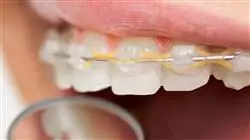 curso periodoncia ortodonciaa oclusionn