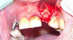 diplomado periodoncia ortodoncia y oclusión