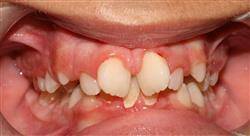 formacion periodoncia ortodoncia y oclusión