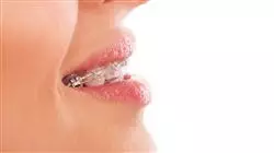 ##IMAGE##