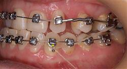 posgrado periodoncia ortodoncia y oclusión