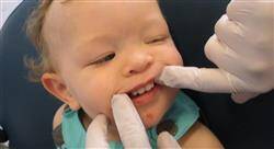 especializacion caries dental infantil: patología y terapéutica actualizada