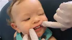 ##IMAGE##