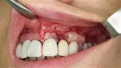 ##IMAGE##