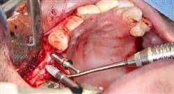 posgrado mantenimiento del paciente periodontal e implantado