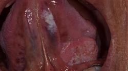 curso master medicina oral Tech Universidad